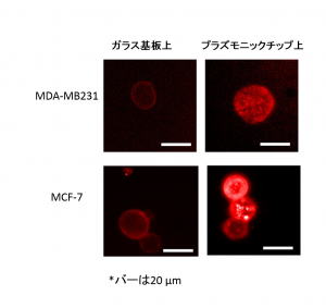 乳癌細胞図