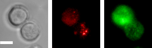 Dual-fluorescence imaging